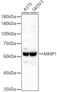MMP1 Rabbit Monoclonal Antibody