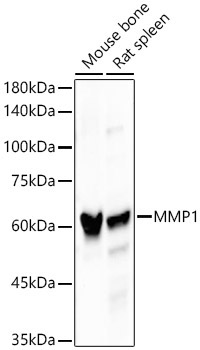 MMP1 Rabbit Monoclonal Antibody - Image 2