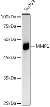 MMP1 Rabbit Polyclonal Antibody