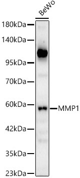 MMP1 Rabbit Polyclonal Antibody