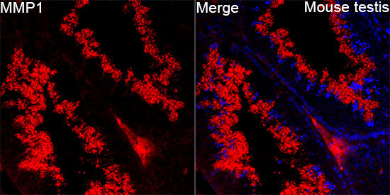 MMP-1 Rabbit Polyclonal Antibody