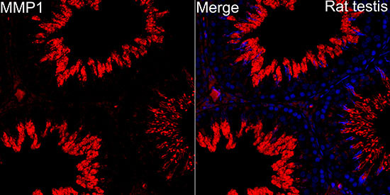 MMP-1 Rabbit Polyclonal Antibody - Image 2