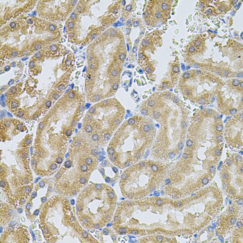 MMP10 Rabbit Polyclonal Antibody - Image 2