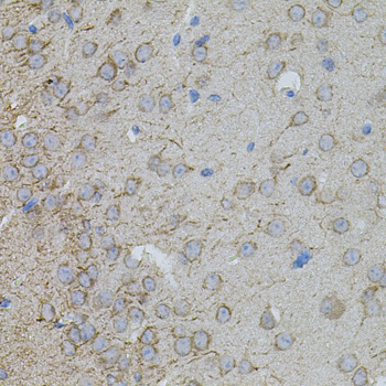MMP10 Rabbit Polyclonal Antibody - Image 3
