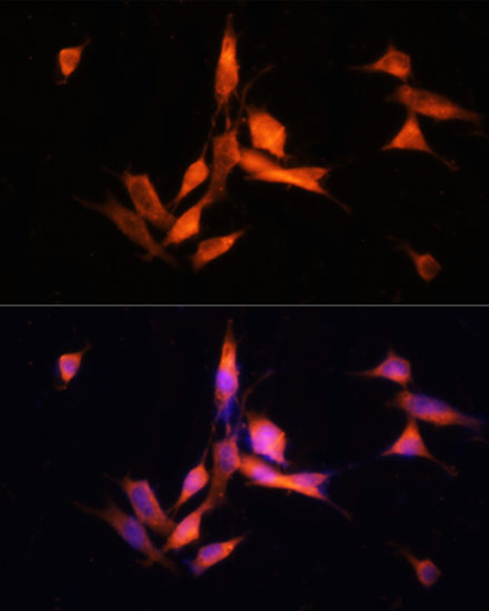 MMP10 Rabbit Polyclonal Antibody - Image 4