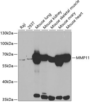 MMP11 Rabbit Polyclonal Antibody