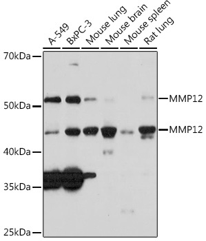 MMP12 Rabbit Monoclonal Antibody