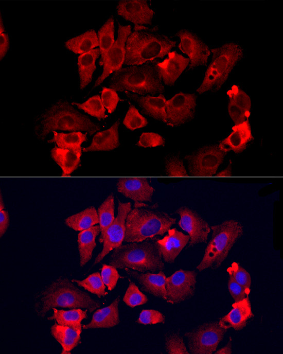 MMP12 Rabbit Polyclonal Antibody - Image 2