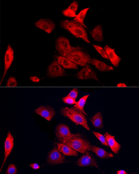 MMP12 Rabbit Polyclonal Antibody - Image 3