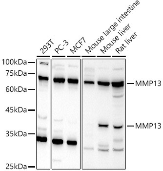 MMP13 Rabbit Polyclonal Antibody