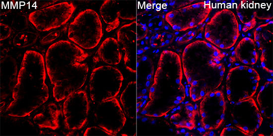 MMP14 Rabbit Polyclonal Antibody - Image 2