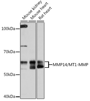 MMP14/MT1-MMP Rabbit Monoclonal Antibody