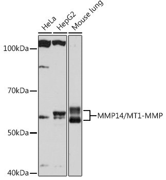 MMP14/MT1-MMP Rabbit Monoclonal Antibody - Image 2