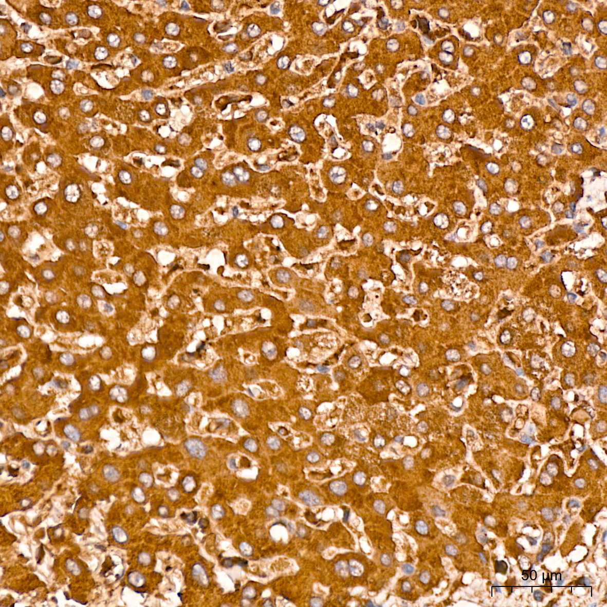 MMP14/MT1-MMP Rabbit Monoclonal Antibody - Image 3