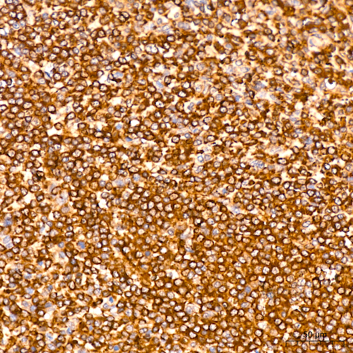 MMP14/MT1-MMP Rabbit Monoclonal Antibody - Image 4