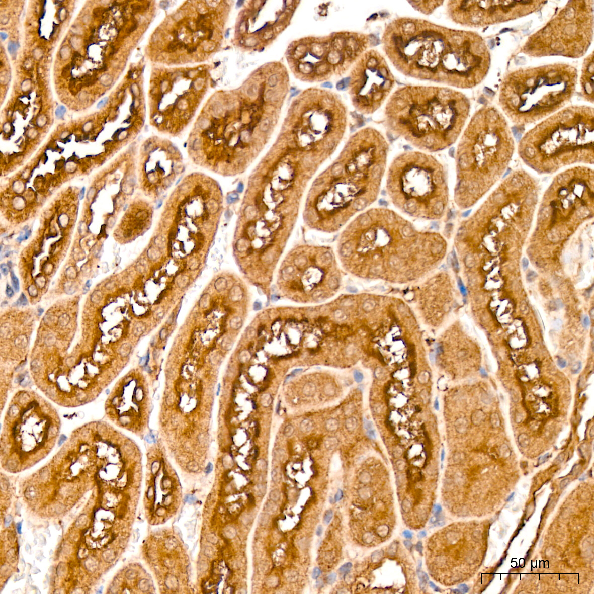 MMP14/MT1-MMP Rabbit Monoclonal Antibody - Image 5