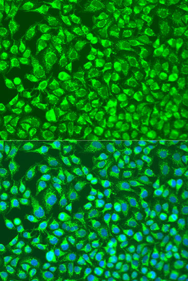 MMP14/MT1-MMP Rabbit Polyclonal Antibody