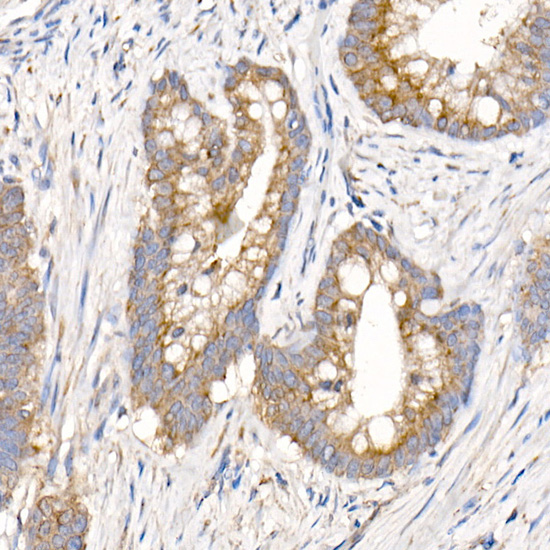 MMP14/MT1-MMP Rabbit Polyclonal Antibody - Image 2