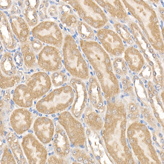 MMP14/MT1-MMP Rabbit Polyclonal Antibody - Image 3