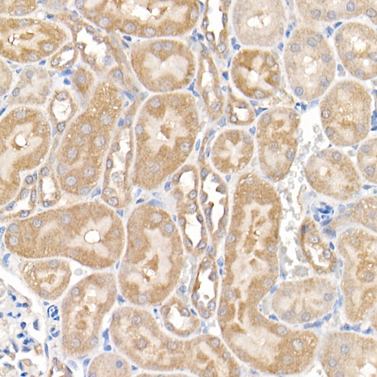 MMP14/MT1-MMP Rabbit Polyclonal Antibody - Image 4