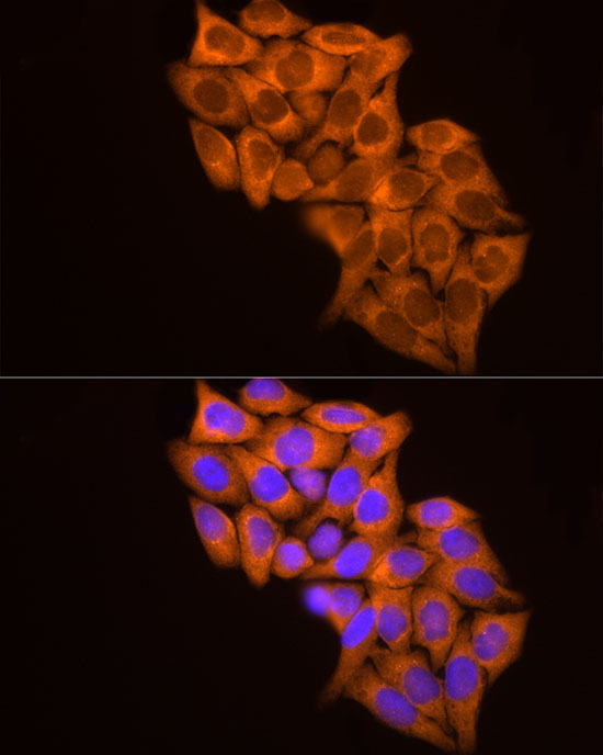 MMP14/MT1-MMP Rabbit Polyclonal Antibody - Image 5