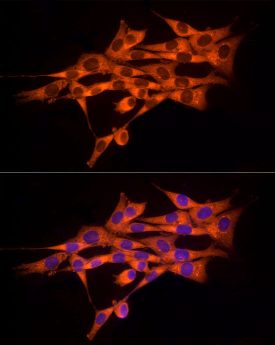 MMP14/MT1-MMP Rabbit Polyclonal Antibody - Image 6