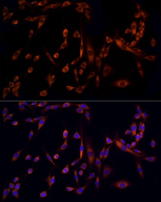 MMP14/MT1-MMP Rabbit Polyclonal Antibody - Image 7