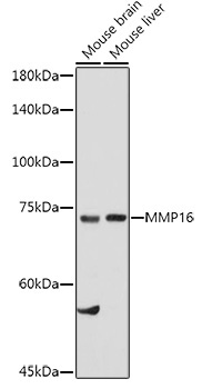 MMP16 Rabbit Polyclonal Antibody
