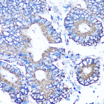 MMP16 Rabbit Polyclonal Antibody - Image 3