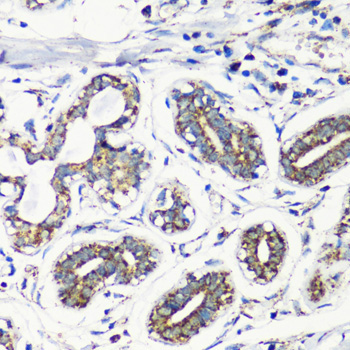 MMP16 Rabbit Polyclonal Antibody - Image 4