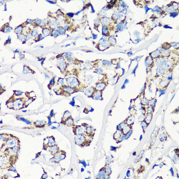 MMP16 Rabbit Polyclonal Antibody - Image 5