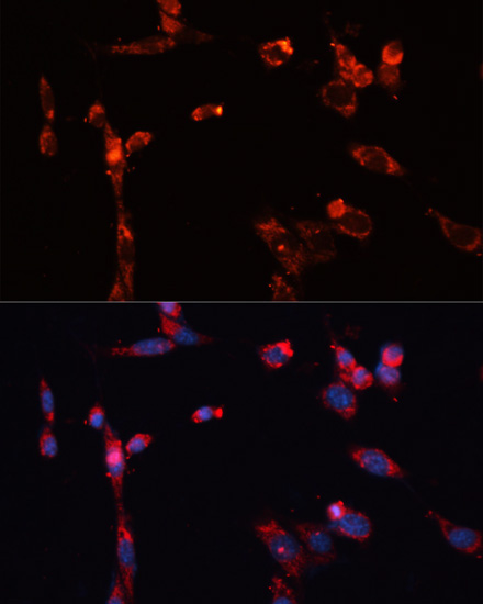 MMP16 Rabbit Polyclonal Antibody - Image 6