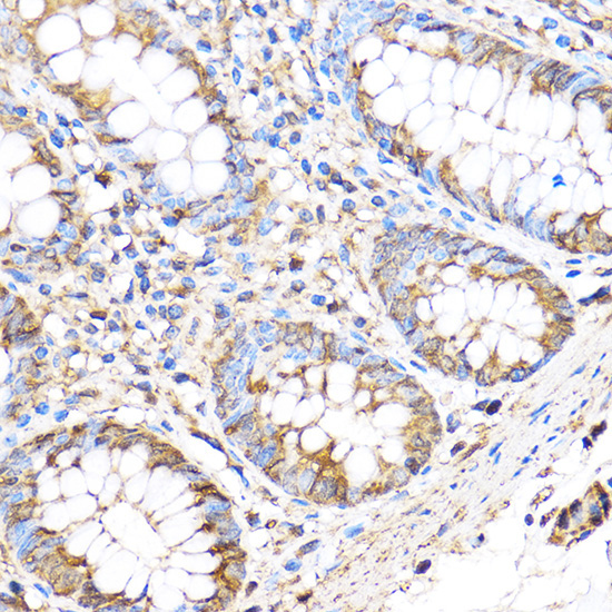 MMP17 Rabbit Polyclonal Antibody - Image 2
