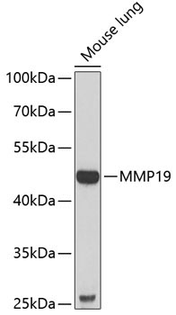 MMP19 Rabbit Polyclonal Antibody