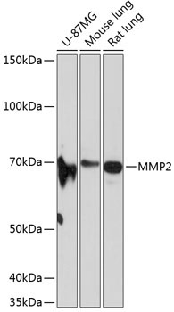 MMP2 Rabbit Monoclonal Antibody
