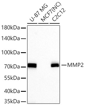 MMP2 Rabbit Monoclonal Antibody