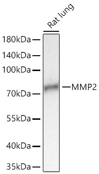 MMP2 Rabbit Monoclonal Antibody - Image 2
