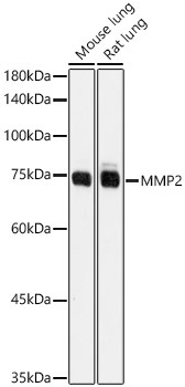 MMP2 Rabbit Polyclonal Antibody