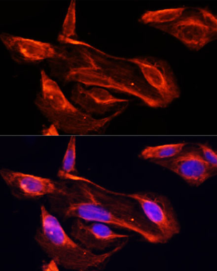 MMP2 Rabbit Polyclonal Antibody - Image 2