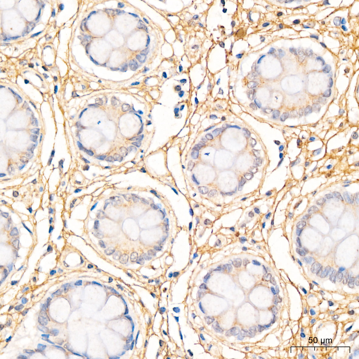 MMP2 Rabbit Polyclonal Antibody