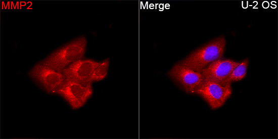 MMP2 Rabbit Polyclonal Antibody - Image 2