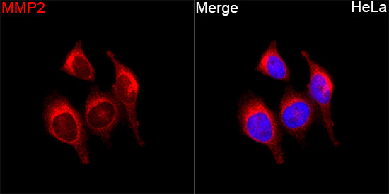 MMP2 Rabbit Polyclonal Antibody - Image 3