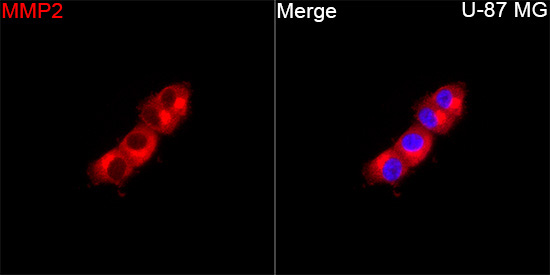 MMP2 Rabbit Polyclonal Antibody - Image 4