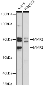 MMP2 Rabbit Polyclonal Antibody