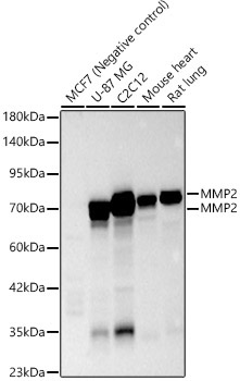 MMP2 Rabbit Polyclonal Antibody - Image 2