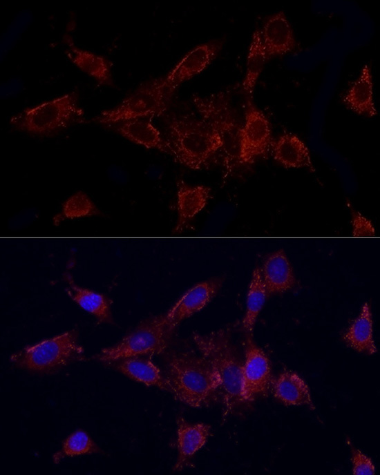 MMP2 Rabbit Polyclonal Antibody - Image 3