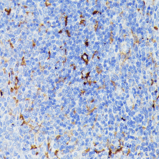 MMP25 Rabbit Polyclonal Antibody - Image 2