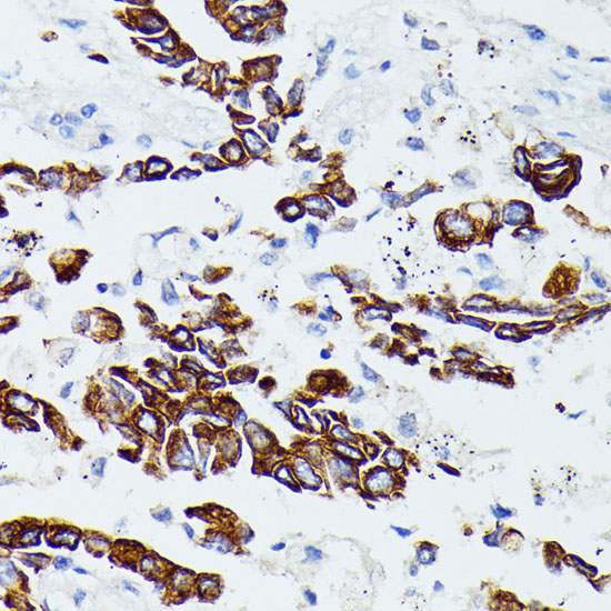 MMP25 Rabbit Polyclonal Antibody - Image 3