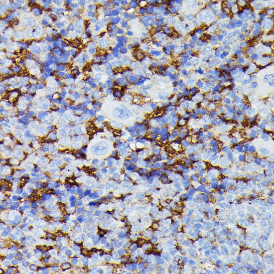 MMP25 Rabbit Polyclonal Antibody - Image 4