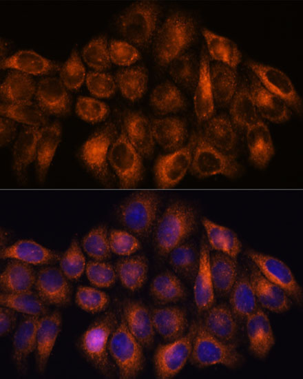 MMP25 Rabbit Polyclonal Antibody - Image 5